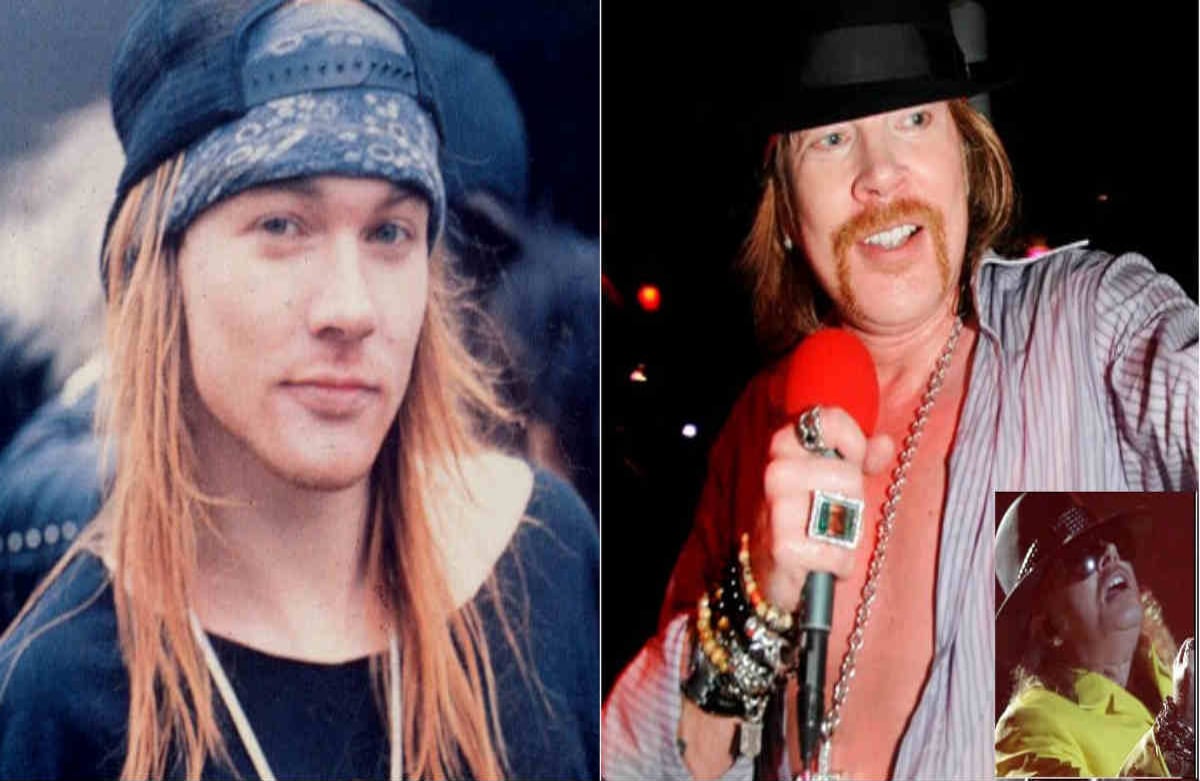 Aunque el líder de Guns N’ Roses, Axl Rose, no ha confirmado los rumores, cirujanos plásticos de Hollywood especulan sobre una blefaroplastia (levantamiento de los párpados), además de rellenos y estiramientos faciales. 