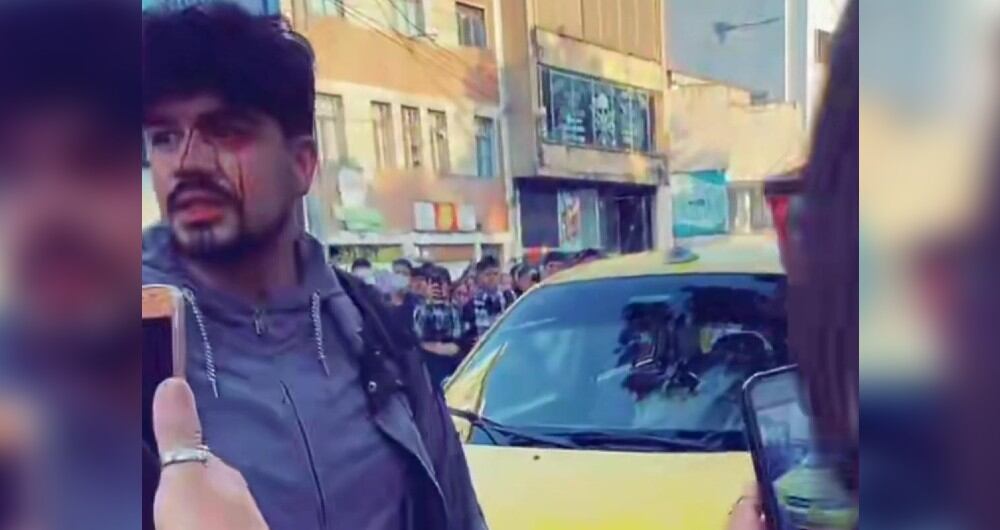 Este fue uno de los miembros del sindicato del Sena que resultó herido