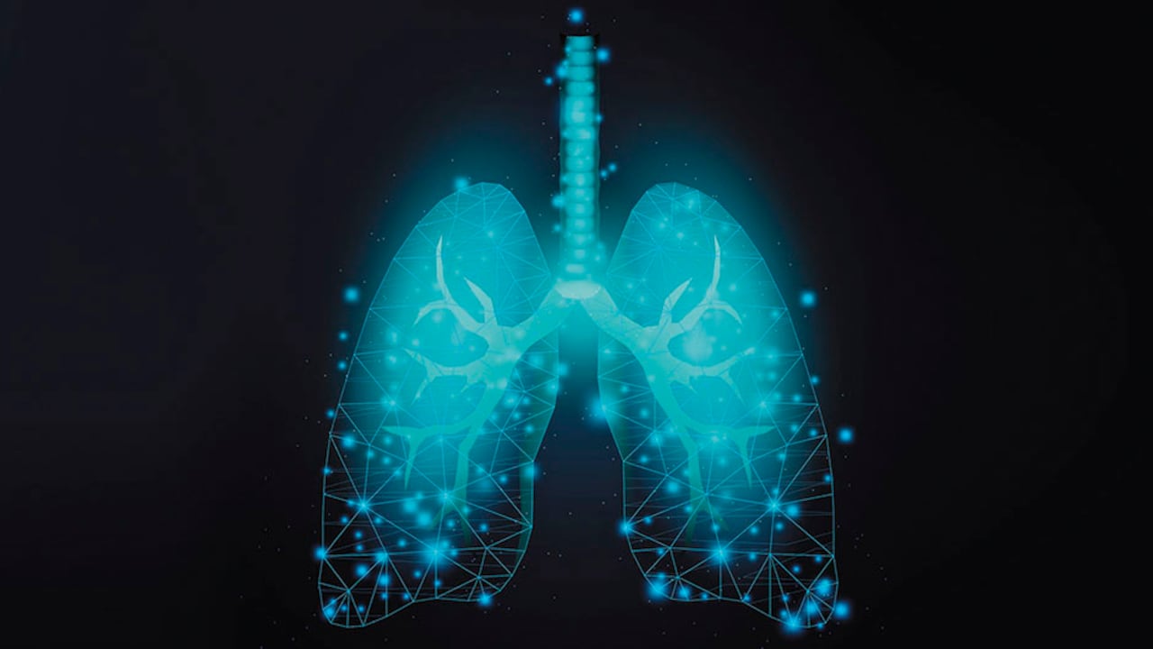 Hoy se tiene una gran cantidad de posibilidades terapéuticas con alta capacidad de control de la enfermedad, pero sobre todo, que garantizan calidad de vida para los pacientes.