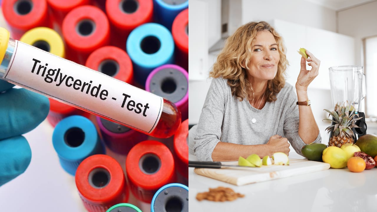 Una dieta balanceada es clave para disminuir los triglicéridos.