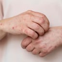 Esta enfermedad puede ser sistémica, puede afectar cualquier órgano y sistema, en particular el hematológico, musculoesquelético, renal y nervioso.