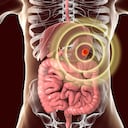El cáncer de estómago empieza cuando las células en este órgano crecen de manera descontrolada.