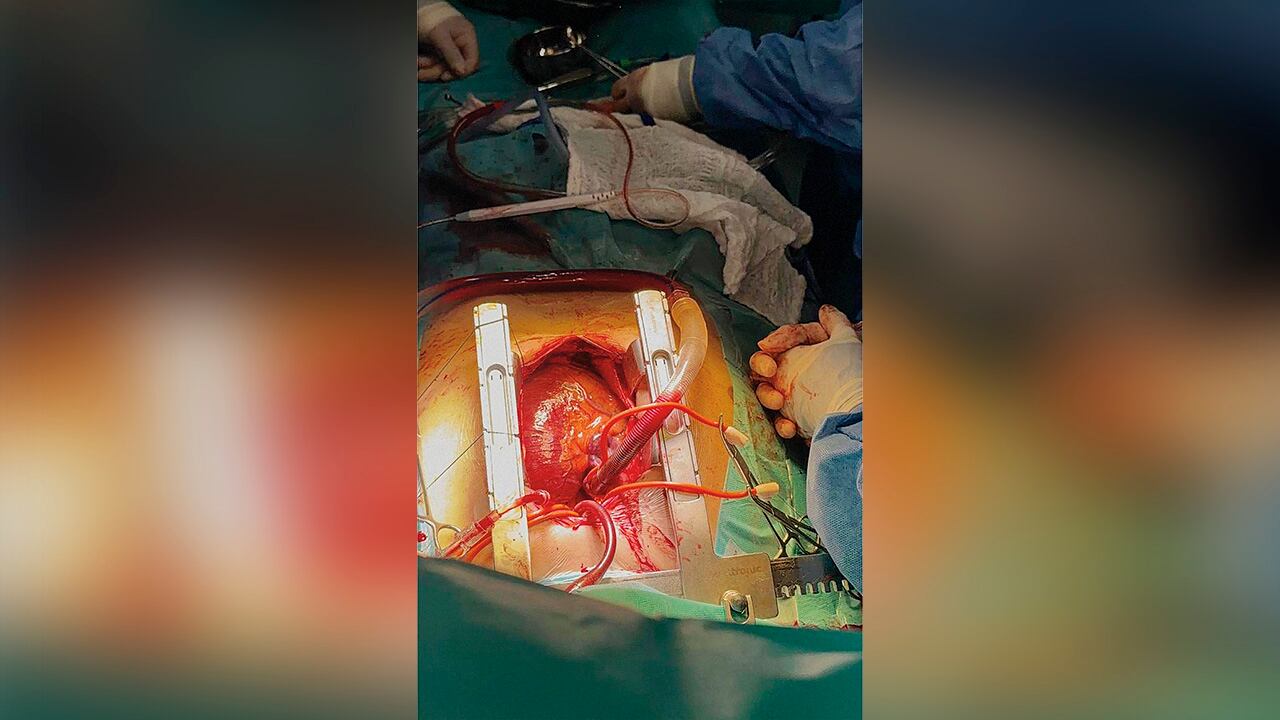 Una nueva esperanza_2