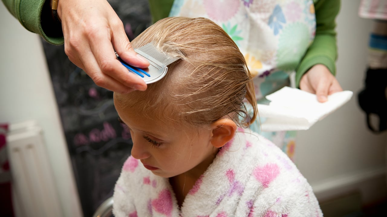 Los piojos de la cabeza pueden vivir hasta 30 días en una persona.