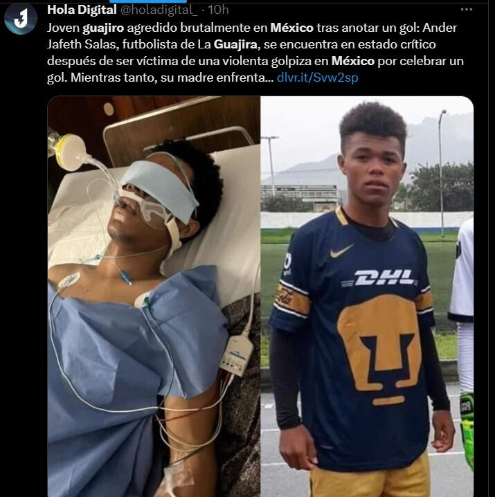 Ander Jafeth Salas Mejía está en coma.