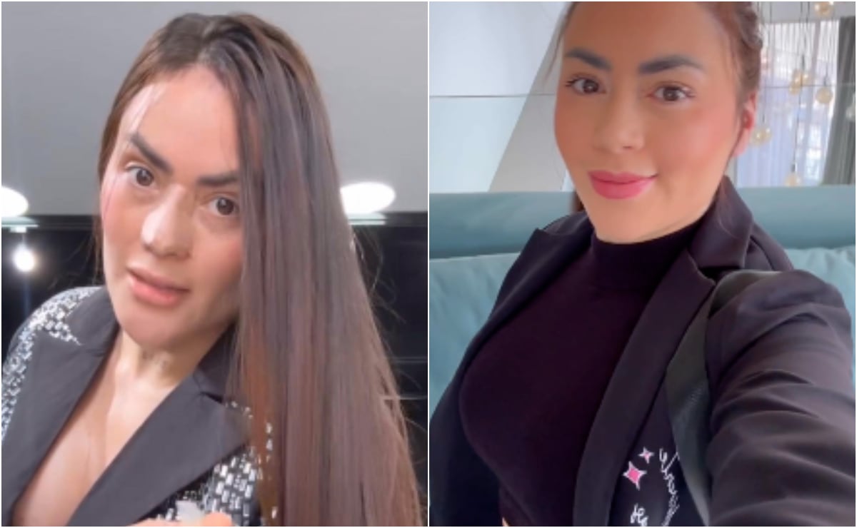 Epa Colombia ha sido tendencia en las redes sociales, tras mostrar los resultado de su cirugía estética en el rostro.