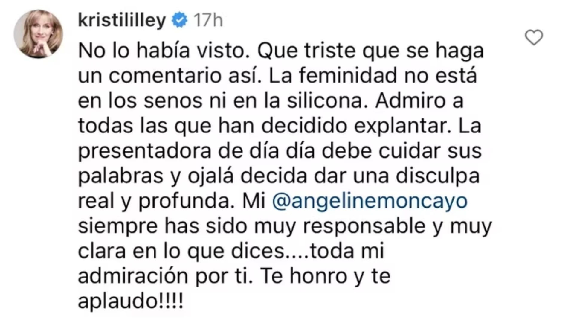 Kristina Lilley y su opinión en redes sociales sobre lo dicho por Carolina Cruz.