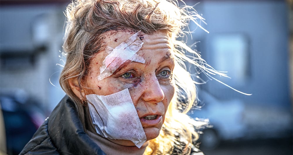 DOS AÑOS DE LA GUERRA  EN UCRANIA_3