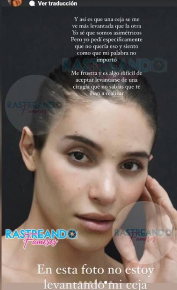 Frustración de la modelo por tema de su rostro.