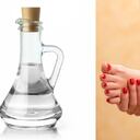 El ácido acético del vinagre ayuda a conseguir una hidratación y calmar la comezón en los pies. Foto: Getty Images.