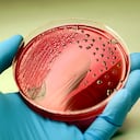 Colonies of a deadly bacteria Salmonella producing red colonies with black centre (hydrogen sulphide -H2S gas) on an XLD agar plate