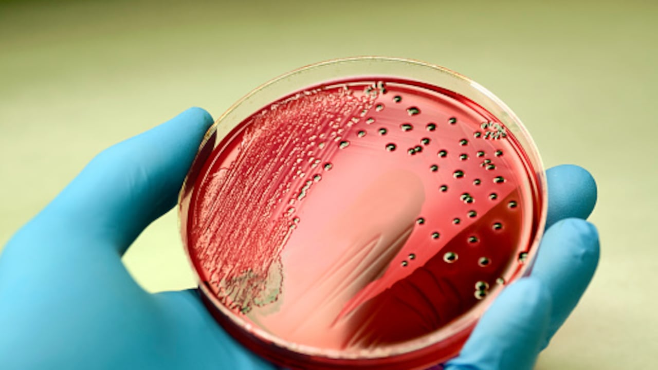 La salmonela, en algunos casos, puede provocar la fiebre tifoidea, una enfermedad potencialmente mortal si no recibe tratamiento adecuado.