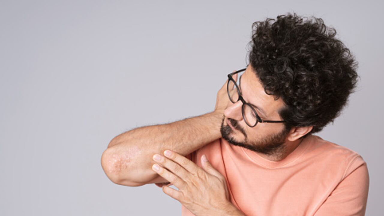 La piel seca es importante de humectar.