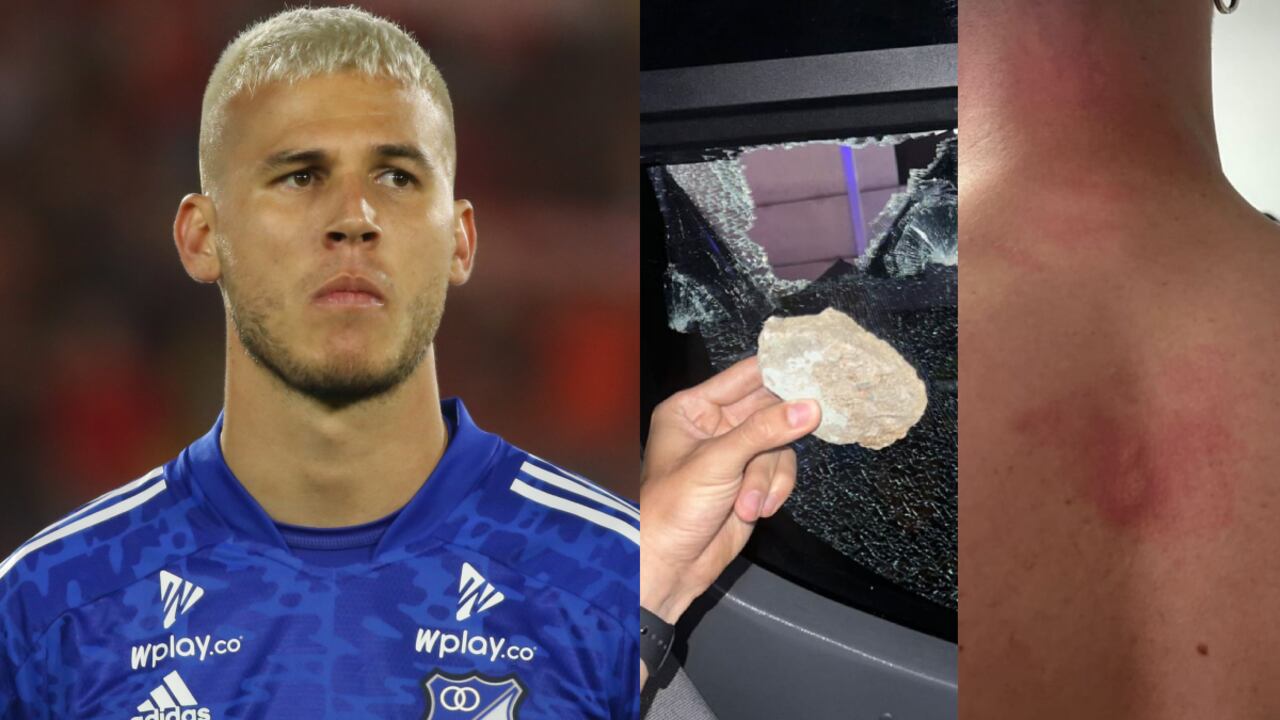 Así quedó la espalda del defensor tras una nueva agresión.