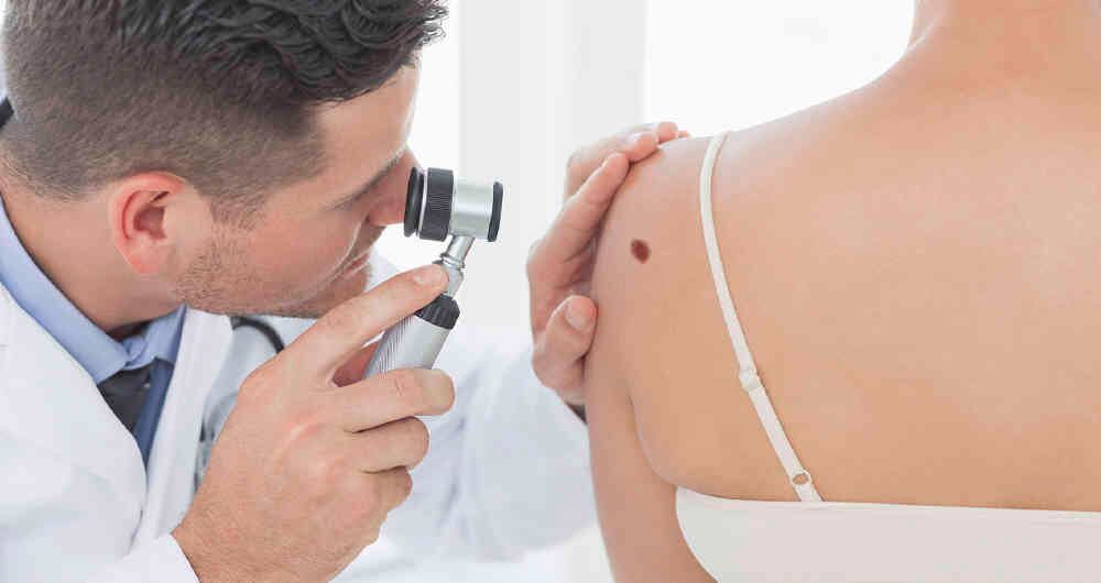 Una mancha que cambia de tamaño, color o diámetro puede indicar el desarrollo de un cáncer de piel.