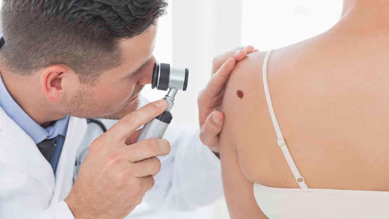 En caso de observar manchas extrañas en la piel se debe acudir a un doctor.