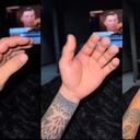 El creador de contenido plasmó el resultado de la mordida que recibió de uno de sus perros.