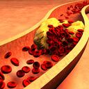 Colesterol en la sangre.