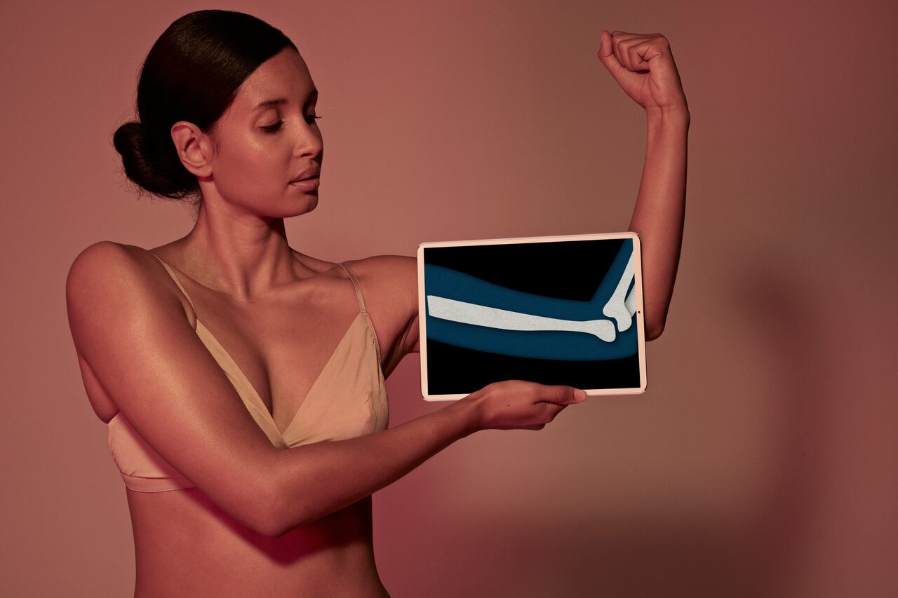 La vitamina D ayuda a mantener los huesos fuertes y saludables.