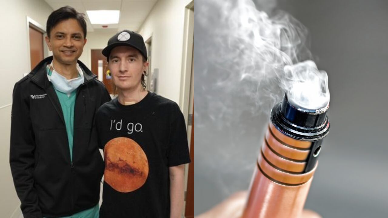 El joven estuvo cerca de perder la vida debido a su adicción por los vapeadores.