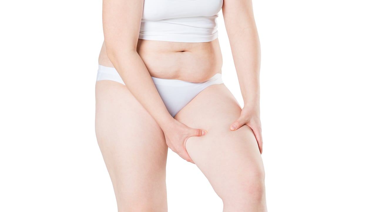 Esta grasa localizada es más notoria en las mujeres.