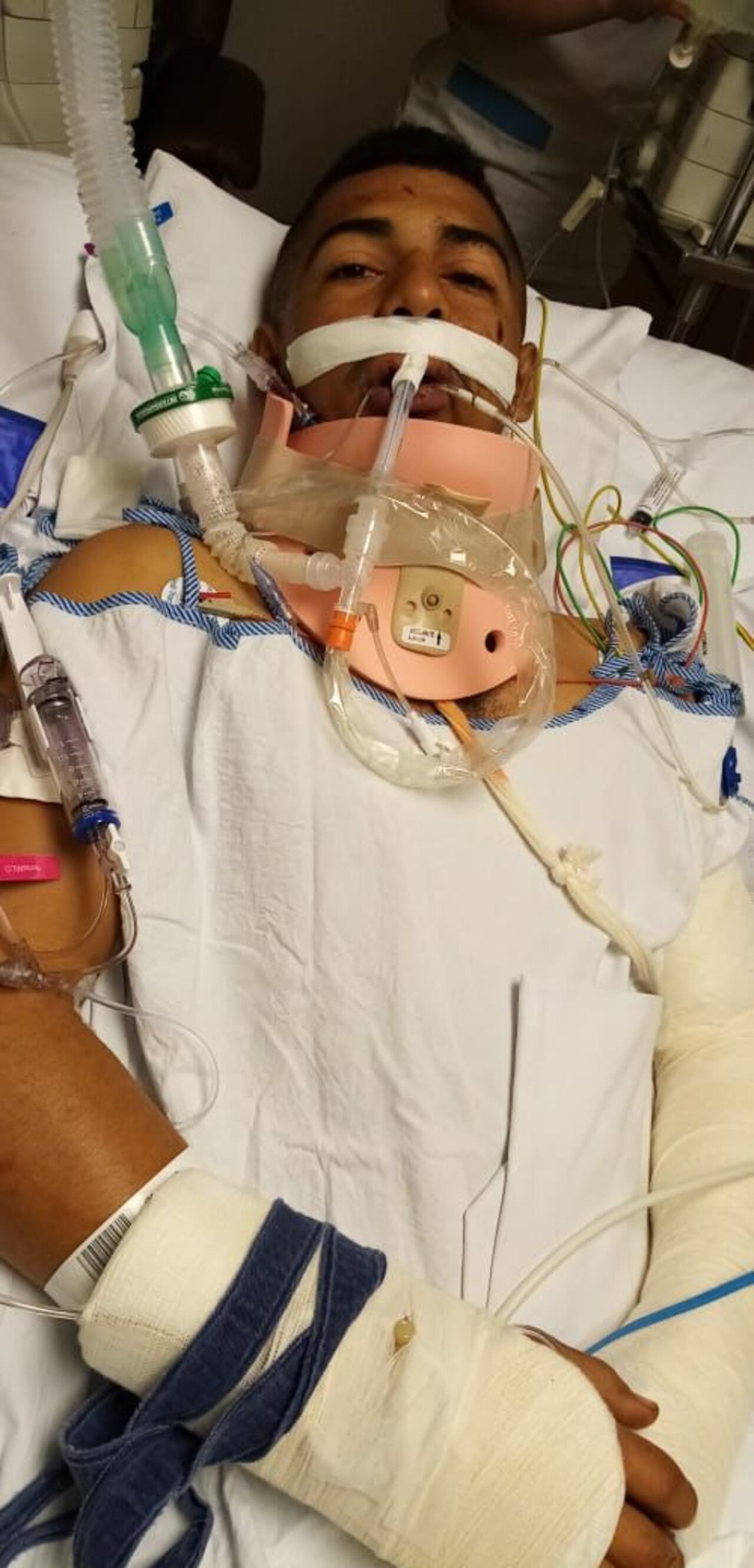 Soldados amputados hacen fila en la Dirección de Sanidad por atención médica o una pensión. Denuncian tramitología.