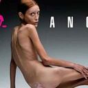 La modelo que apareció en carteles para una campaña de Benetton contra la anorexia en 2007, murió meses después.