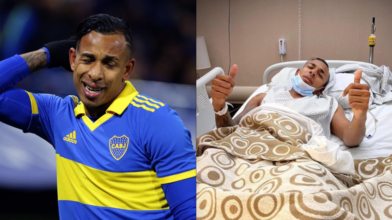 El colombiano fue operado con éxito tras su lesión de rodilla.
