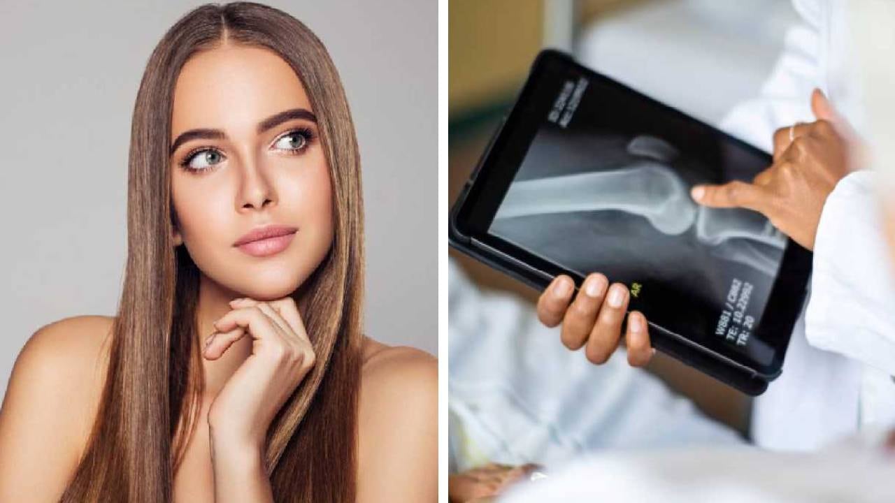 El colágeno es un elemento fundamental para la piel, huesos y tendones. Foto: Getty Images.