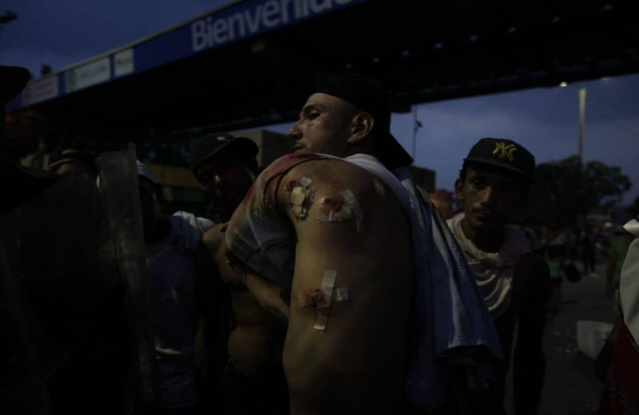 A pesar de sus heridas, este chico permanece en el puente Simón Bolívar, hasta la noche, con la esperanza de lograr su objetivo: hacer retroceder a la Guardia Nacional. Foto: Diana Rey Melo SEMANA