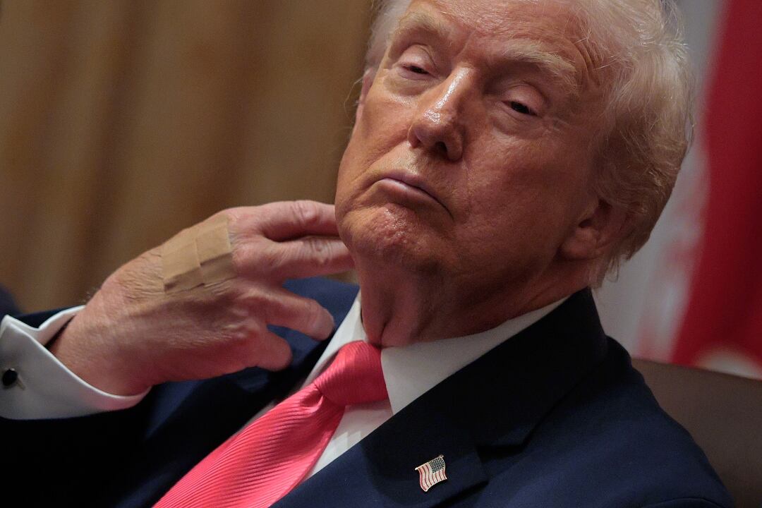 Mano vendada de Donald Trump