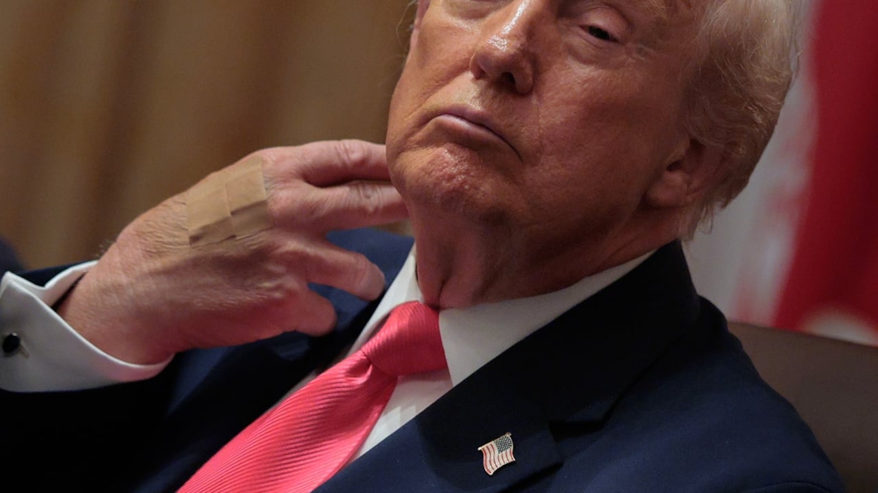 Hay sospechas por la salud de Donald Trump.