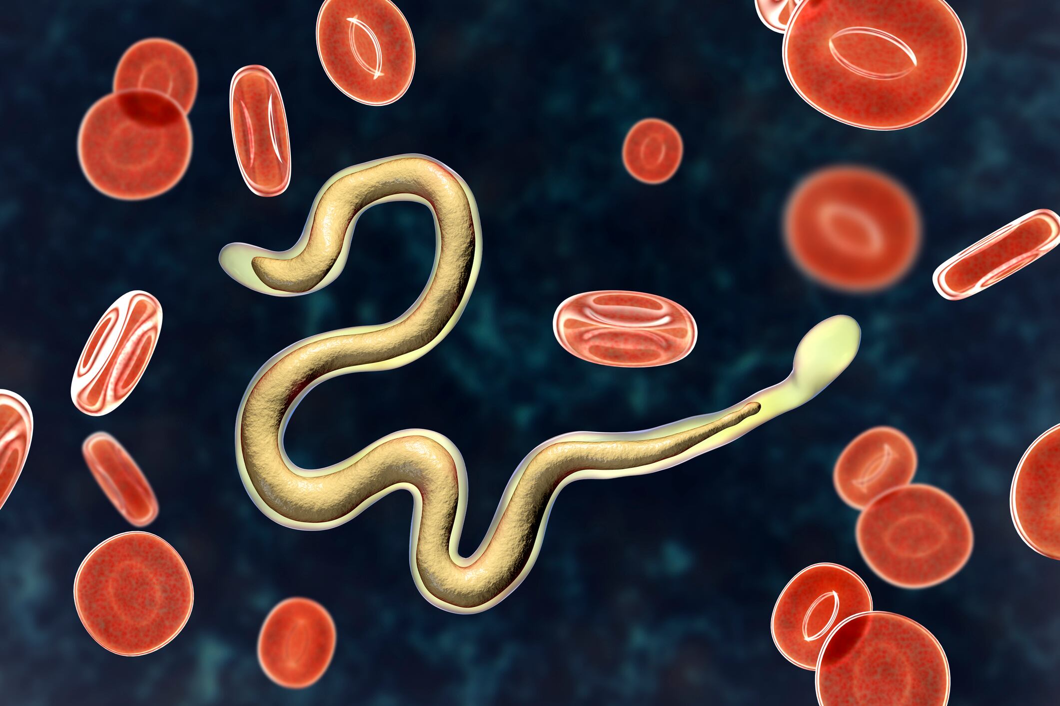 Gusanos - Foto de referencia