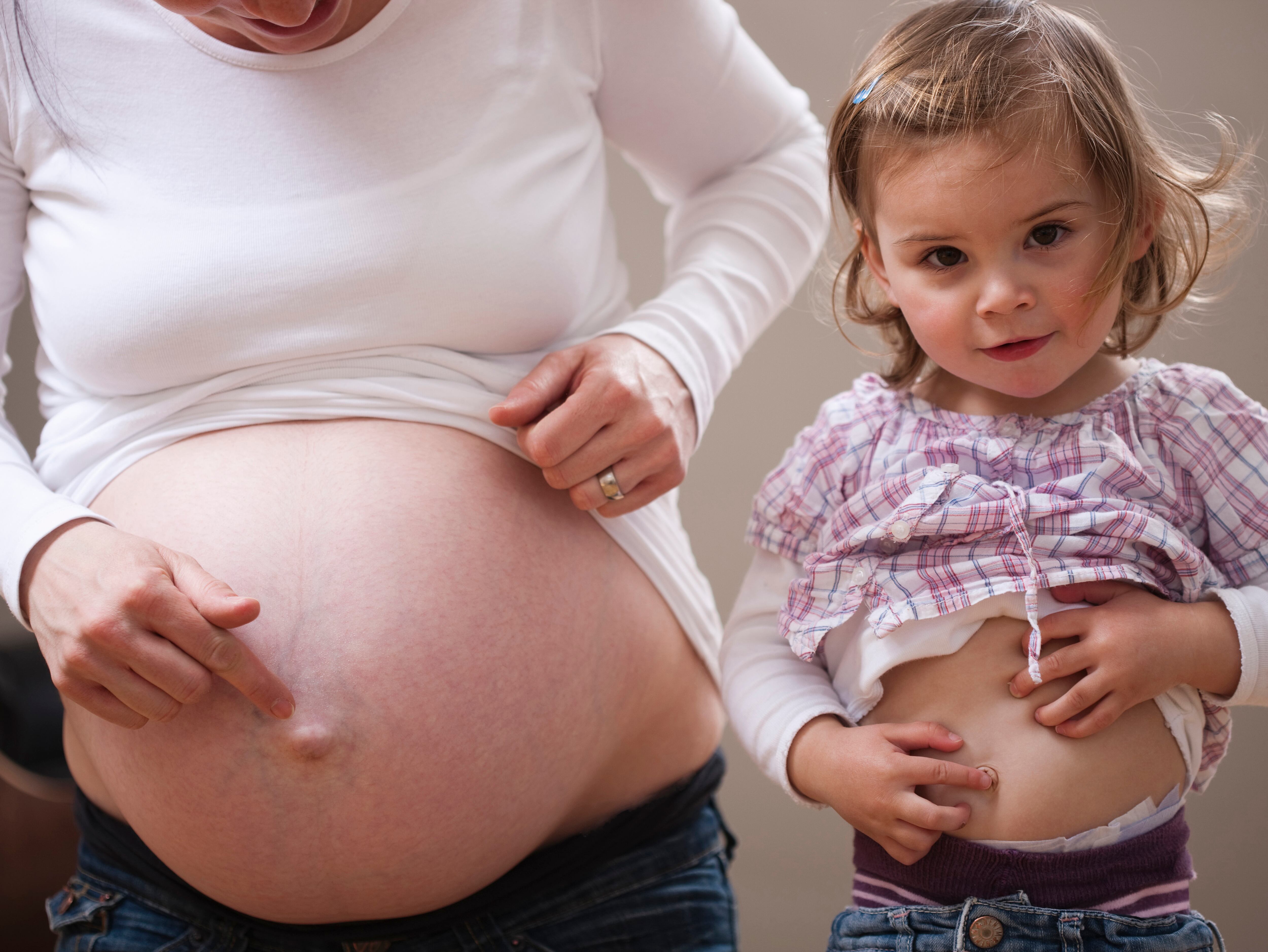 Es importante que los padres enseñen a los hijos a limpiar su ombligo diariamente.