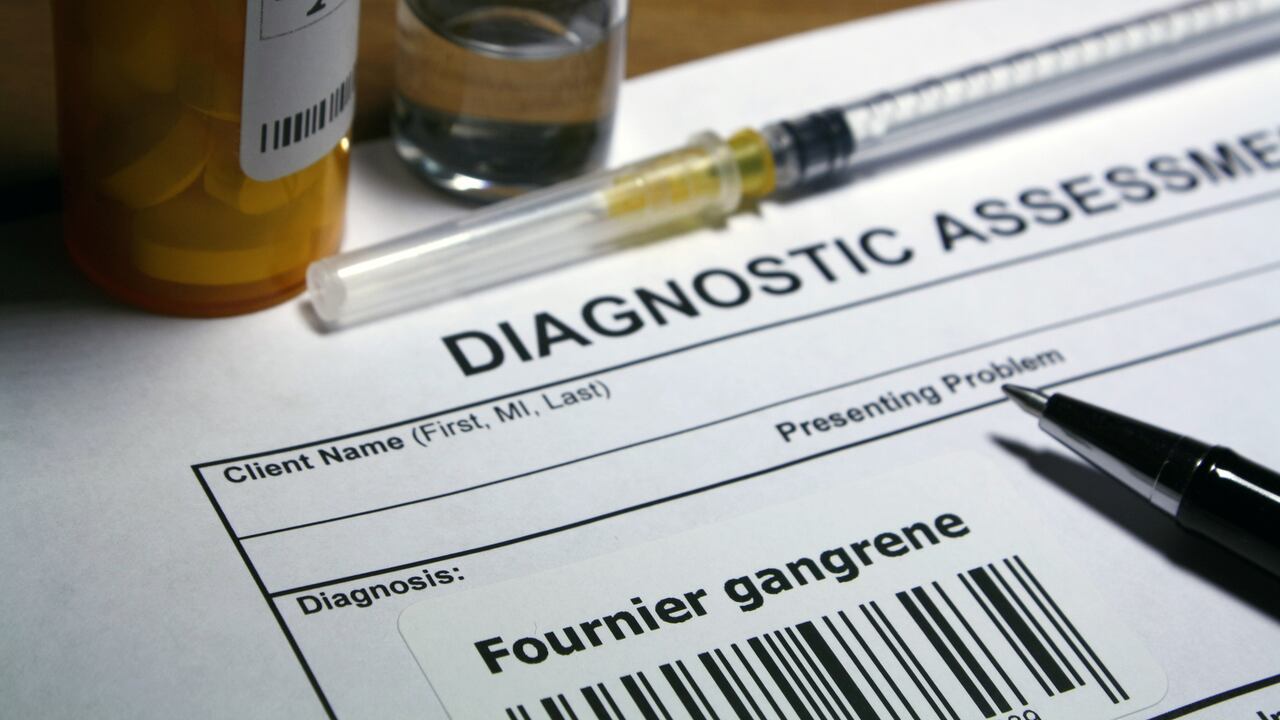 El pie de Louise mostrando los efectos de la infección antes de la cirugía, con una notable hinchazón y enrojecimiento.