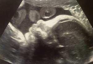 Gerard Piqué, astro del Barcelona de España, publicó en su cuenta de Whosay (Twitter en Asia) y en la de Facebook la primera ecografía de su hijo con la barranquillera.