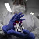 Esteban Vega La-Rotta/SEMANA