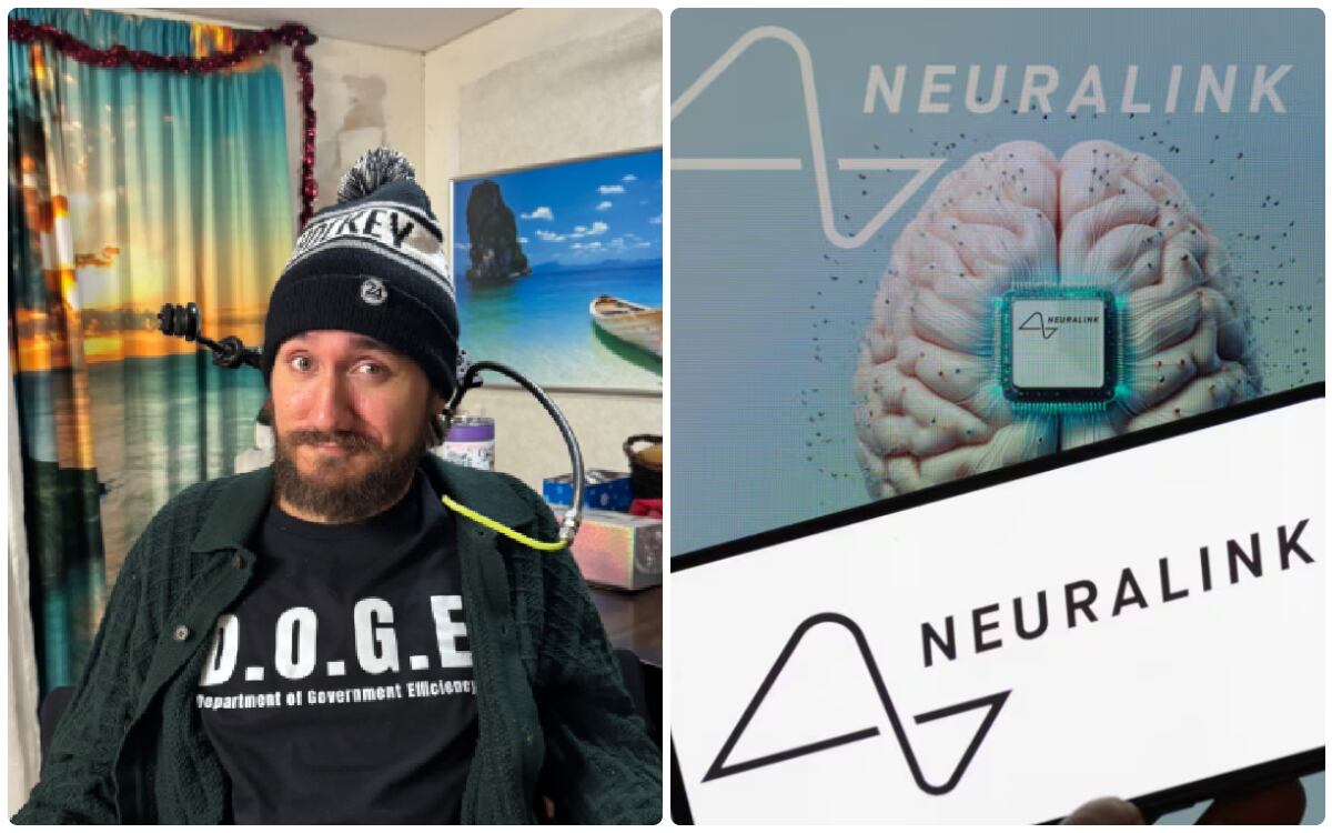 El estadounidense Noland Arbaugh se convirtió en febrero de 2024 en la primera persona en recibir el chip experimental de Neuralink, la empresa de Elon Musk.