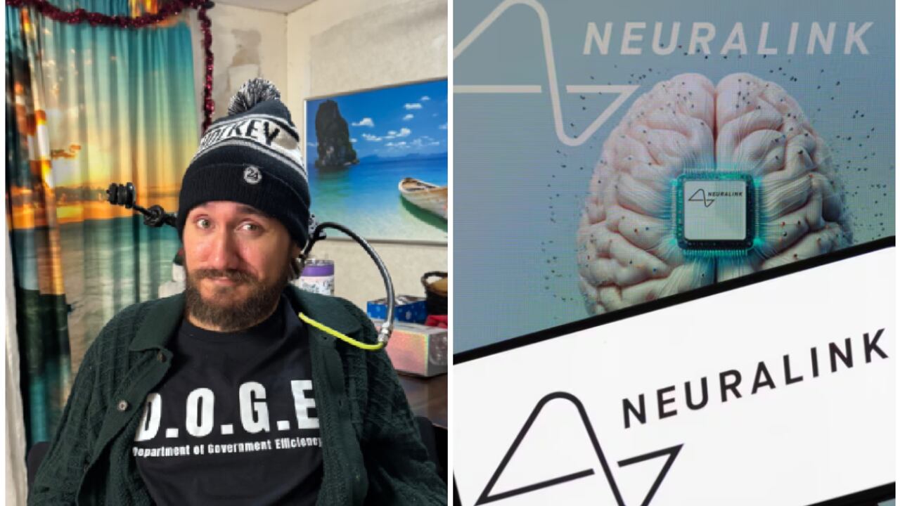 El estadounidense Noland Arbaugh se convirtió en febrero de 2024 en la primera persona en recibir el chip experimental de Neuralink, la empresa de Elon Musk.