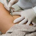 El cáncer de piel puede generarse por la exposición permanete al sol.