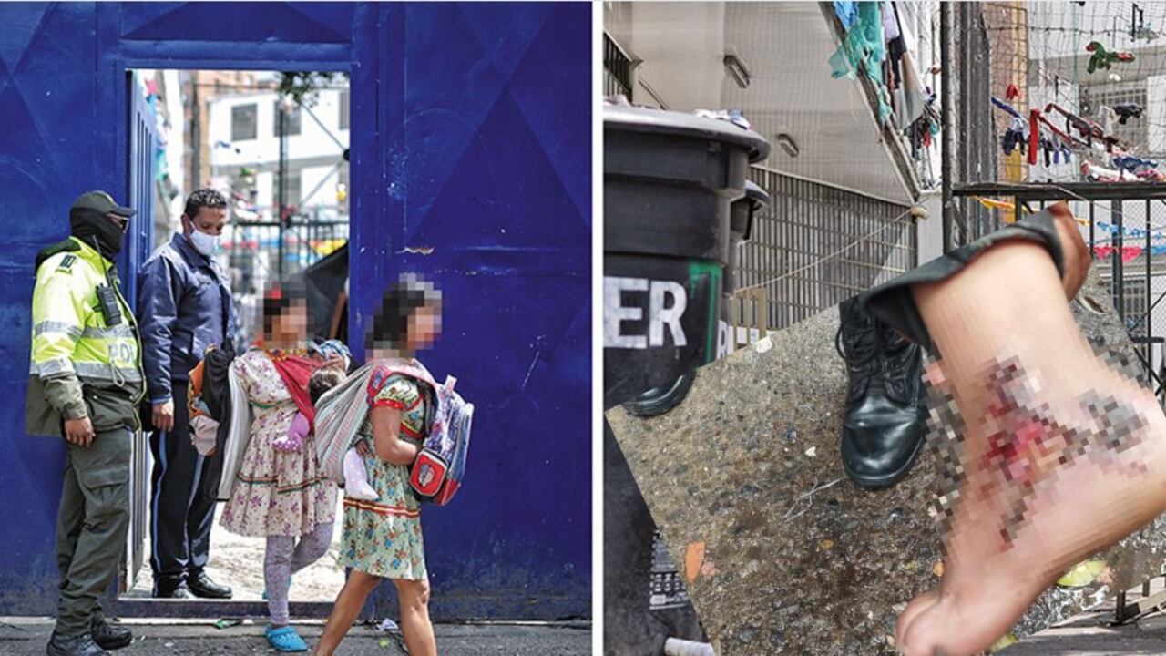 Niño indigena lleva días con quemaduras y en La Rioja no permiten su traslado a un hospital