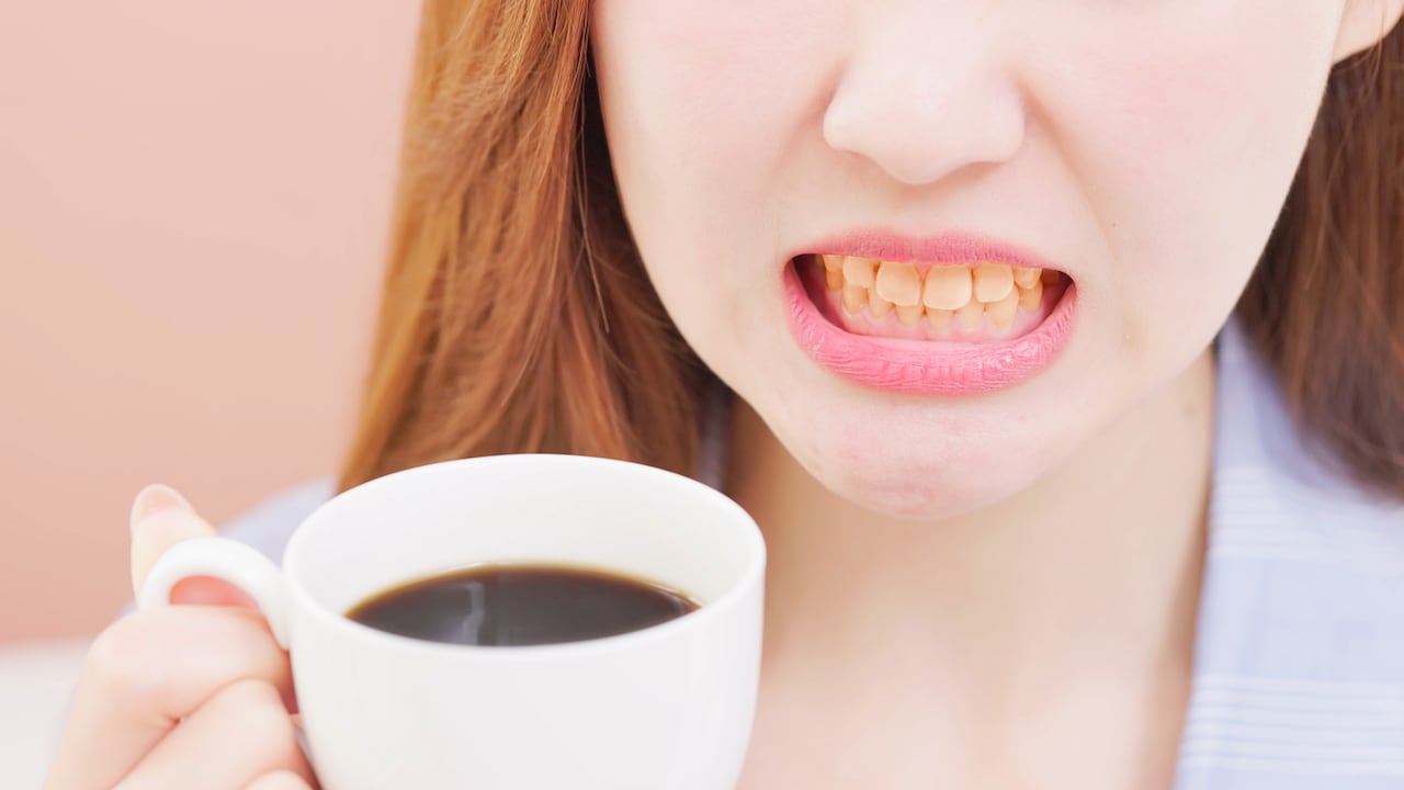 Manchas en los dientes