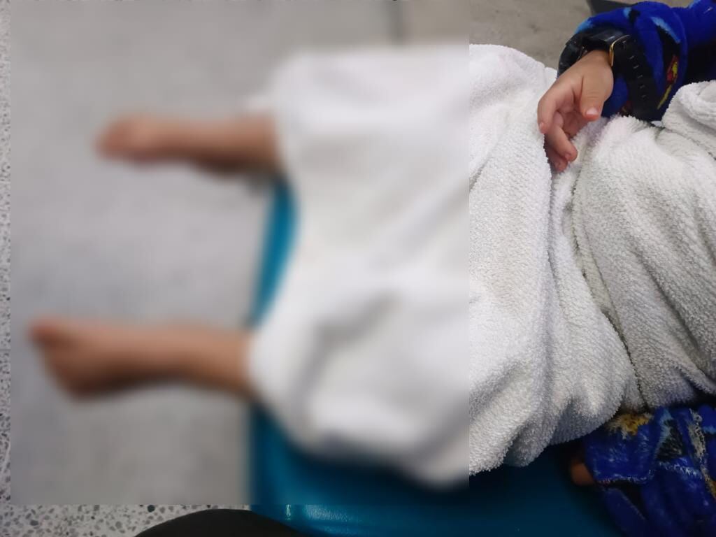 El menor está siendo atendido en el hospital universitario de San Vicente Fundación.