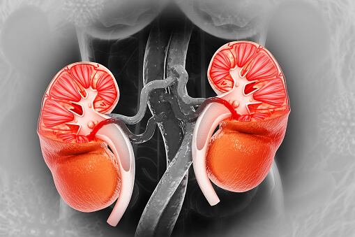 No consumir agua provoca cálculos en los riñones.