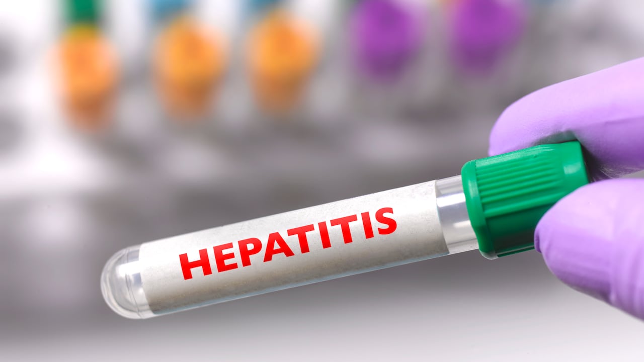 Tubo de ensayo que contiene la vacuna contra la hepatitis