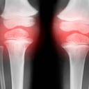 En ocasiones los dolores de rodilla no son fuerte, pero si pueden ser molestos. Foto: Getty images.