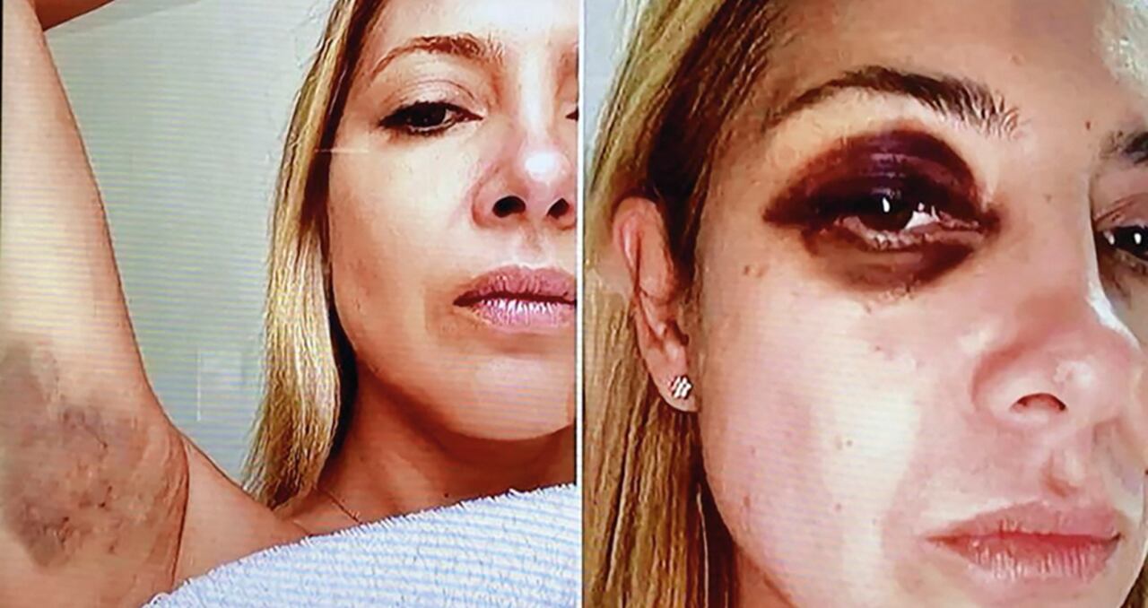 Las imágenes del maltrato recibido por la entonces primera dama han dado la vuelta al mundo. Si bien ella intentó denunciarlo con la ministra de las Mujeres, fue ignorada. Dicha cartera fue cerrada por el Gobierno Milei.