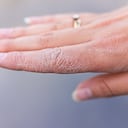 Manos agrietadas pueden aparecer a causa del cambio hormonal.