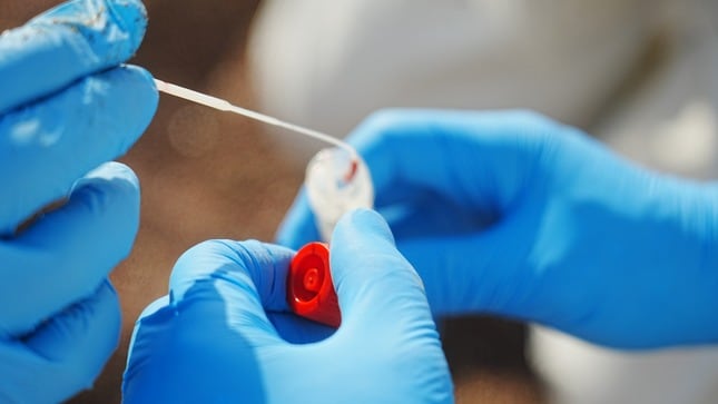 Toma de muestra de un lobo marino afectado por la gripe aviar en Perú.