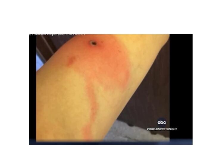 Todas tuvieron casos leves y se recuperaron sin tener que ser hospitalizadas.